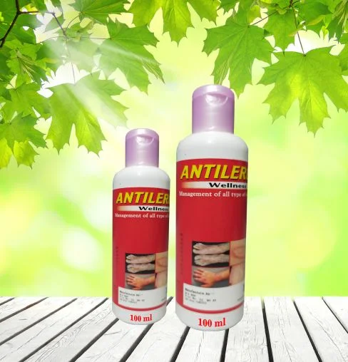 Antialergy Lotion